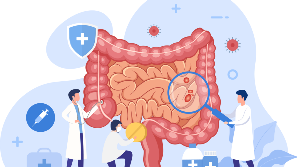 Dor abdominal, azia, queimação, dificuldade para engolir, náuseas, vômitos, alterações do hábito intestinal, diarreia, constipação, prisão de ventre, sangramento gastrointestinal, perda de peso inexplicável.