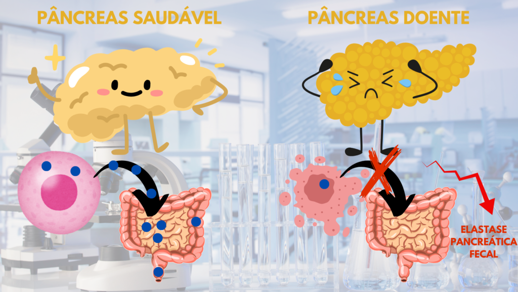 Elastase, Elastase pancreática fecal