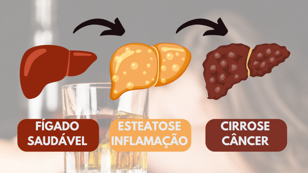 doença hepática alcoólica
álcool